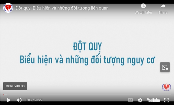 Đột quỵ: Biểu hiện và những đối tượng liên quan