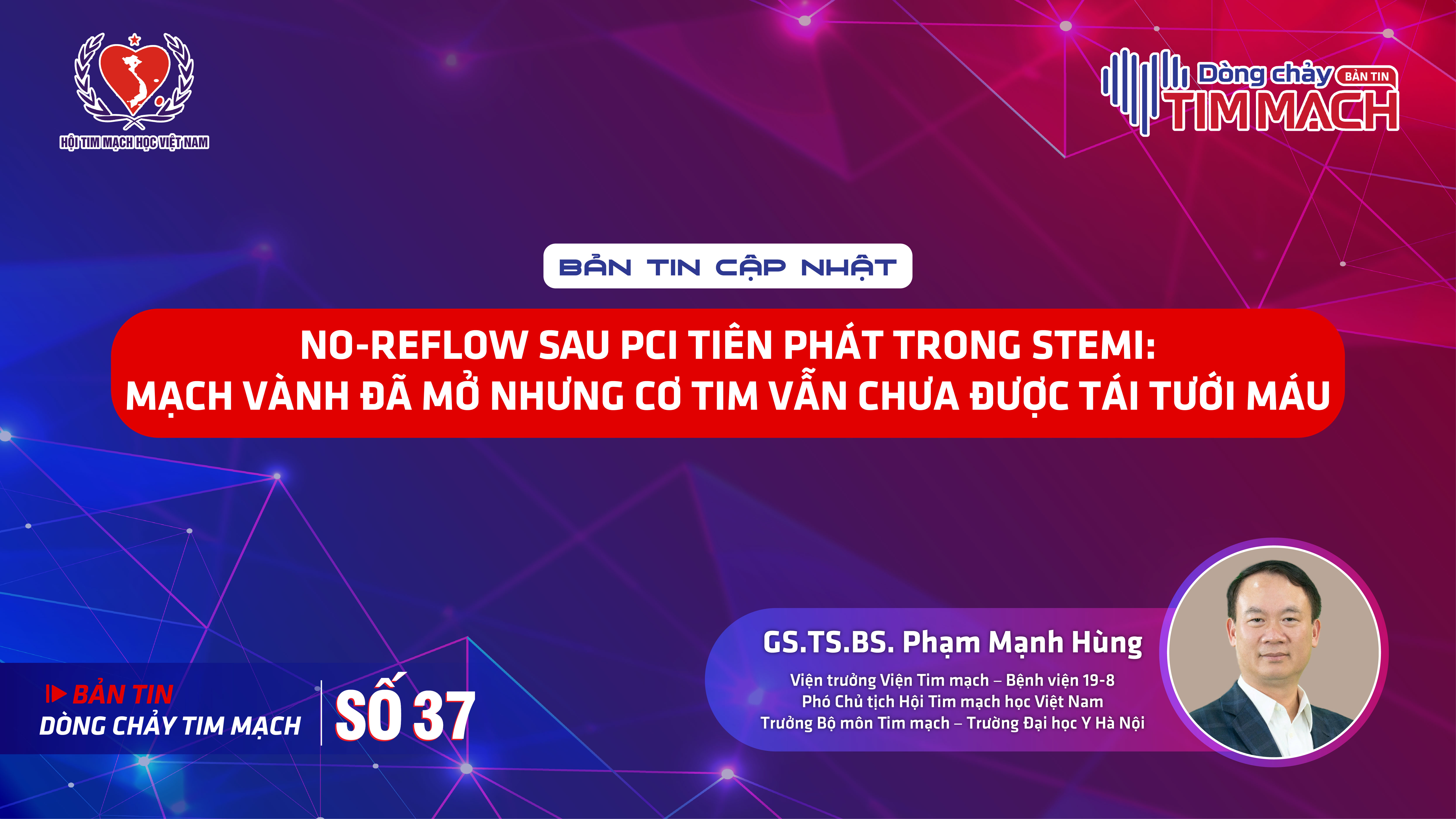 Bản tin Dòng chảy Tim mạch số 37 - No-reflow sau PCI tiên phát trong STEMI: Mạch vành đã mở nhưng cơ tim vẫn chưa được tái tưới máu
